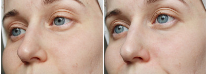 Подходит ли гель для умывания Bioderma Sebium Purifying Cleansing Gel сухой коже?