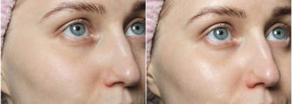 La Roche-Posay Hyalu B5 Anti-Wrinkle Care: качественное увлажнение для любого времени года