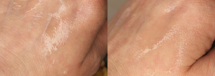 The U Keep calm toner: «узбагоин» для реактивной кожи