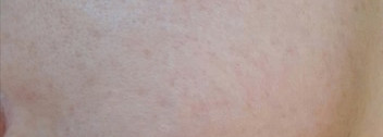 Крем для лица Shiseido Waso Смарт-крем: увлажнение и ровный тон SPF30