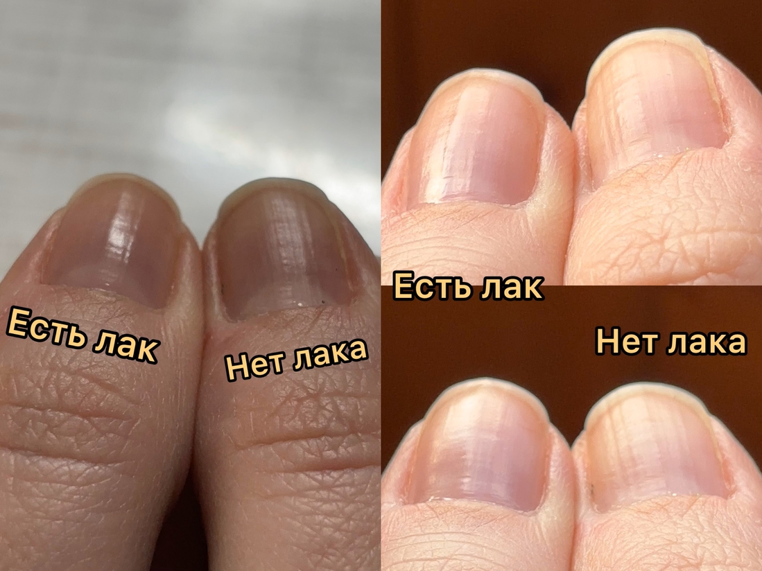 Сравнение накрашенного ногтя и чистого