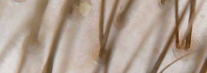 Bisou renewal scalp peeling - бюджетный пилинг для кожи головы