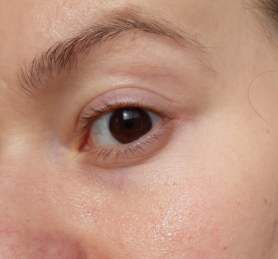 Что такое эссенция для кожи вокруг глаз
