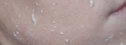 Отличный бюджетный уход от Bielita Mezocomplex - мезопилинг-скатка для лица и мезомаска для лица. Фото "до" и "после"