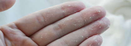 Корейский яблочный пилинг-скатка Mizon Apple Smoothie Peeling Gel