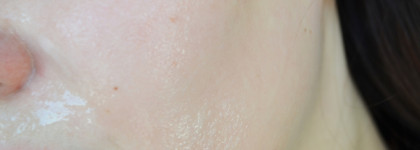 Корейский яблочный пилинг-скатка Mizon Apple Smoothie Peeling Gel