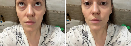 Clarins Total Eye Lift Concentrate - "до" и "после" спустя 2 месяца