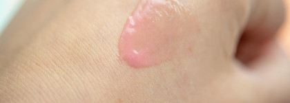 Верный друг Kiko 3D Hydra Lipgloss 07 Pink Magnolia