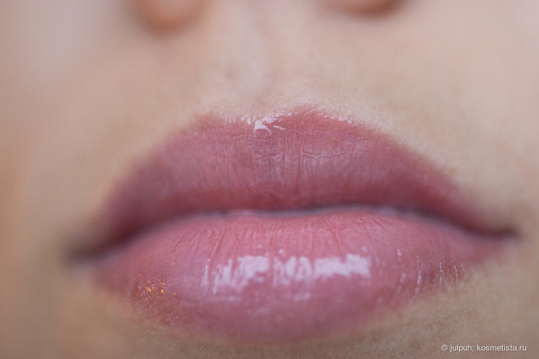 Чем мазать губы для восстановления обкусанной кожи?