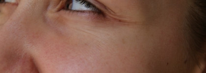 Первые мимические морщинки и It's skin Power 10 formula WR effector with Adenosine. Справился?