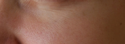 Первые мимические морщинки и It's skin Power 10 formula WR effector with Adenosine. Справился?