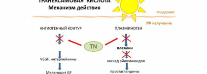 Транексамовая кислота и коррекция гиперпигментации