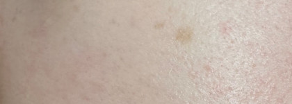 Сыворотка против пигментации Celimax Pore+Dark Spot Brightening Serum. Результат до/после