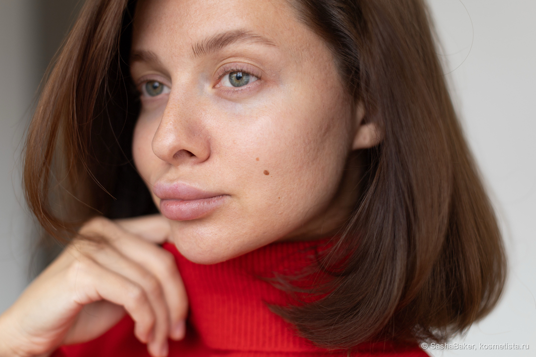 спустя месяц восстановления кожи сывороткой Clarins. Фото без макияжа