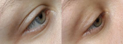 Гель для кожи вокруг глаз Свобода "Карина" с липосомами