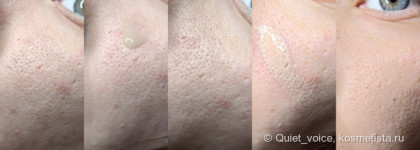 Неудачный люкс. Как делать не надо. Праймер для лица Guerlain L'Essentiel Primer