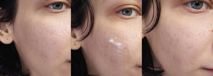 Увлажняющий крем с центеллой азиатской и натуральными экстрактами Uvinion