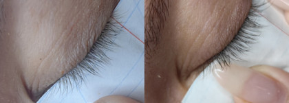 Помогает ли сыворотка XLASH Eyelash Serum отрастить ресницы? Проверяю на себе