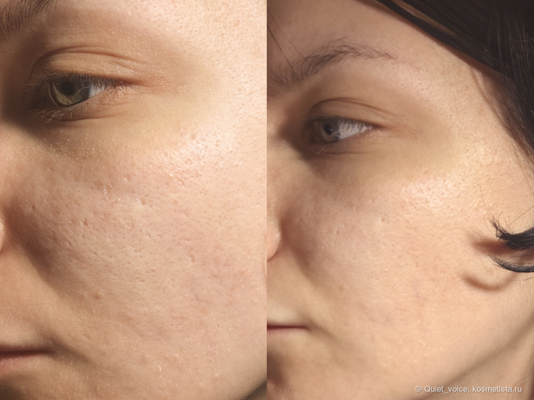 Comfort zone sublime skin