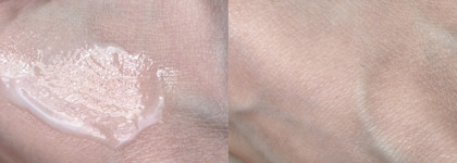 Что такое гиалуроновая кислота? Крем для лица "Невская косметика" увлажняющий гиалуроновый