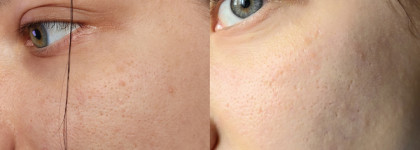 Крем для лица, который нравится мне. Facial cream Halsa with niacinamide, vitamin C, avocado oil and probiotics