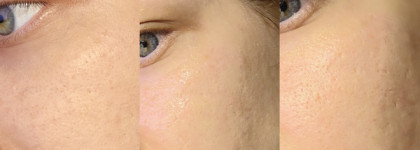 Это снова случилось со мной. Ok beauty