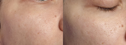 Недорогой уход с ретинолом. Обзор крема Невская косметика "Ретинол"