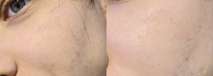 Самая питательная маска для лица: питательная маска для лица Art&fact после пилинга с церамидами.  Ceramide Complex 3% + Panthenol 0,5% + Rejuvenating Complex 1% 