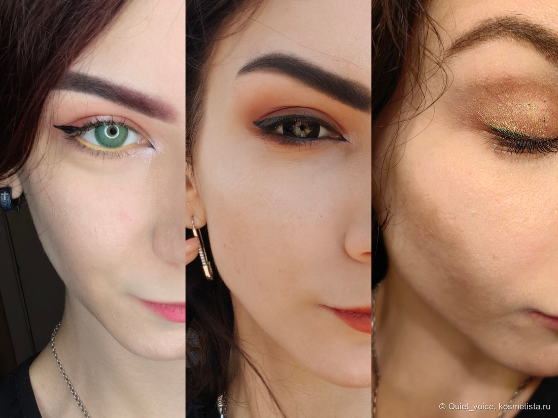 Филлеры в лицо - угол челюсти, подбородок, скулы и губы