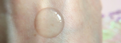 Booster Bar Botox-Effect Booster и Lymfotonic Toner. Фото до и после