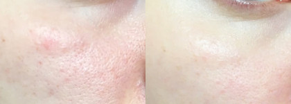 10 лучших продуктов этого лета