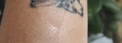 Еще одна рабочая сыворотка от SOME BY MI: проверено на обезвоженной коже с шелушениями