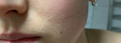 Missha Super Aqua Ultra Hyalron Peeling Gel - нежное очищение и комфорт или деньги на ветер?