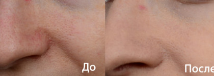 Минеральная пудра Mineral Foundation SPF 15 от Lily Lolo - покупать или нет?