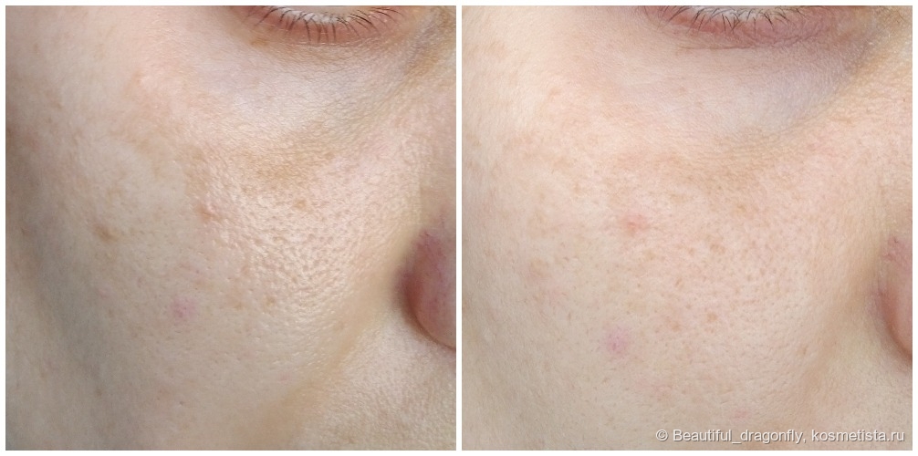 Разница между фото 3 недели