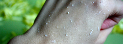 Dr. G Brightening Peeling Gel - мягкий пилинг-скатка для чувствительной кожи