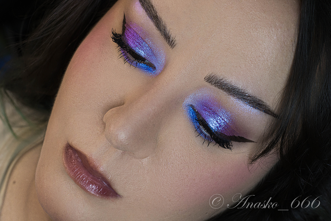 Ursa Major на подвижном веке. Doppler Blue на нижнем веке и внутреннем уголке.