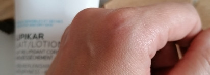 Если кожа тела сохнет, шелушится и зудит. Мой помощник La Roche-Posay Lipicar lotion Lipo-replenshing body lotion