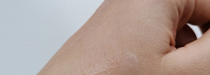 Don't touch my skin azacid. Кажется, она со мной надолго