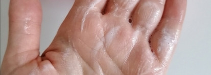 Что помогло мне остановить выпадение волос после ковида и стресса