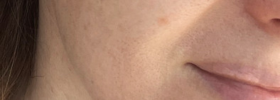 Моментальный лифтинг эффект, которого я не ожидала: MartiDerm The Originals Proteos Hydra plus SP