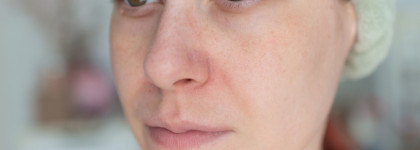 Dnkbeauty Say No to Acne Pore Balancing Toner и комбинированная кожа 30+