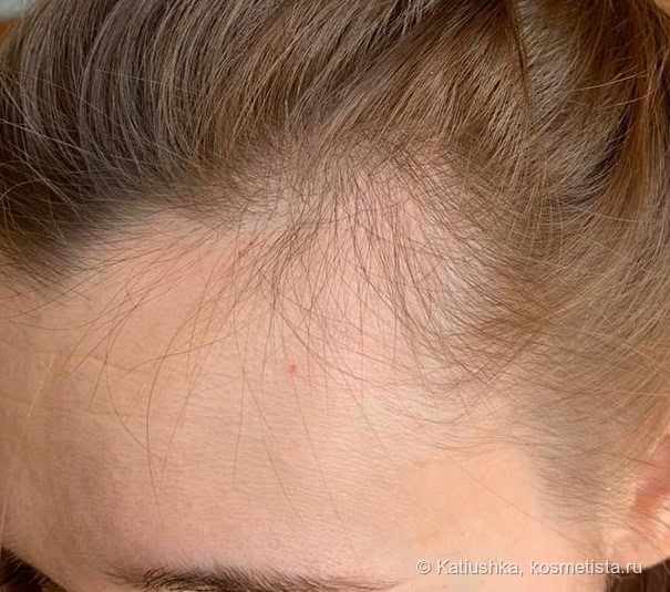 Масло от выпадения волос дзинтарс