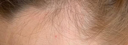 Борьба за волосы вместе с Dzintars, DNC, Hobe Labs