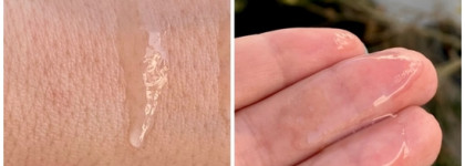 Есть акне? Есть решение! Моя подборка средств для кожи с акне