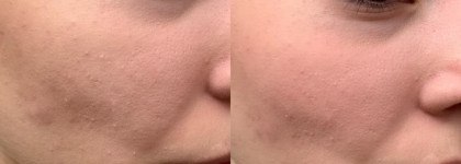 Теплый летний день с Revolution