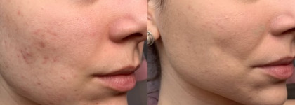 Продукты Rimmel, о которых Вы забыли или не обратили внимание