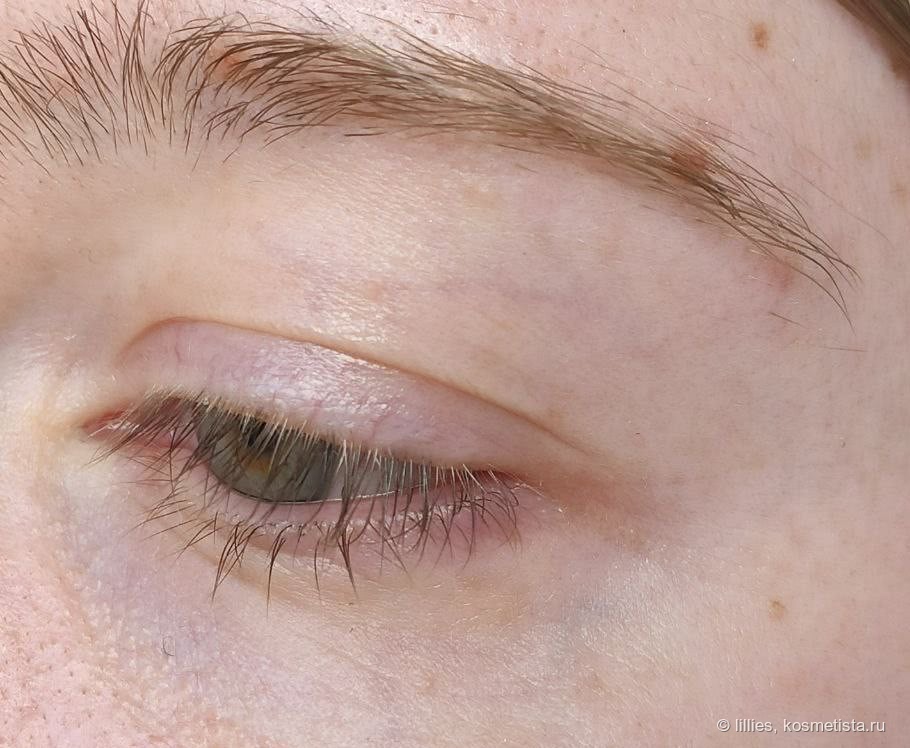 Limoni Hyaluronic Ultra Moisture Eye через 8 часов
