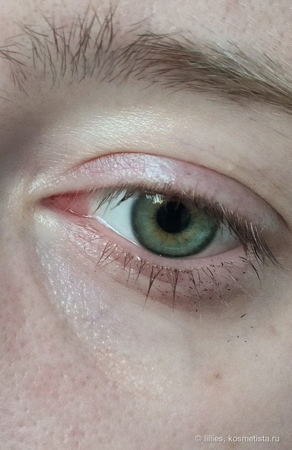 Глаза после очищения гидрофильным маслом
