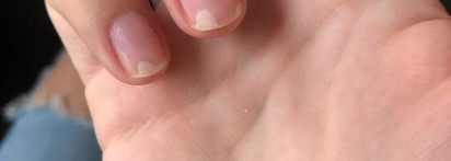 Лосьон для защиты и восстановления поврежденных ногтей "Клавио": грустная история со счастливым концом